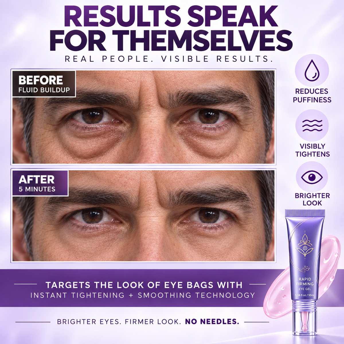 Before and after style eye-area results graphic