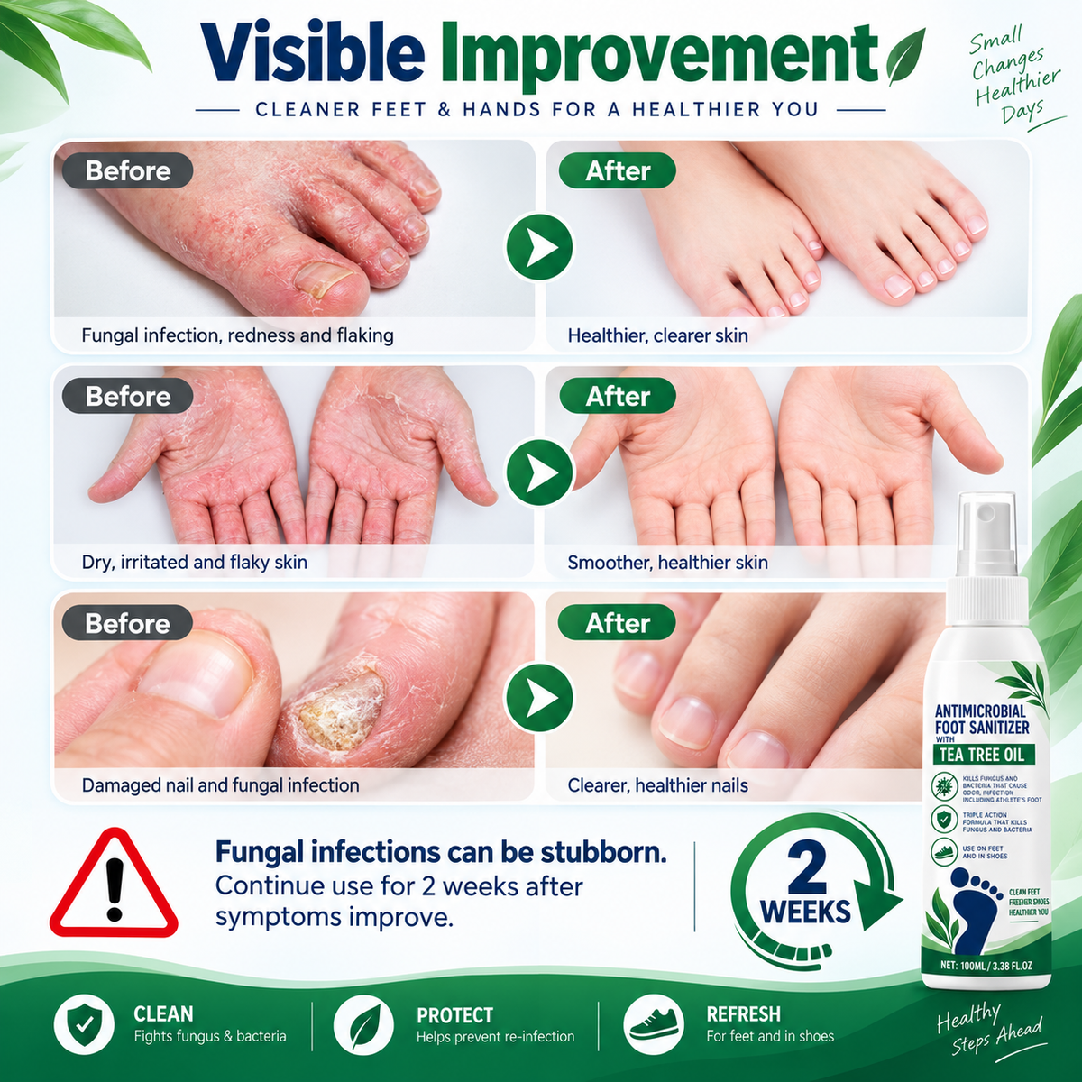 Tea Tree Oil Antifungal Foot Spray - Cracked Heels & Dry Skin Repair