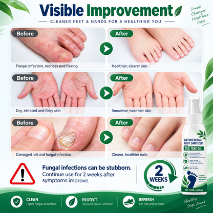 Tea Tree Oil Antifungal Foot Spray - Cracked Heels & Dry Skin Repair